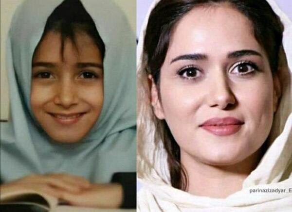 عکس قبل عمل پریناز ایزدیار