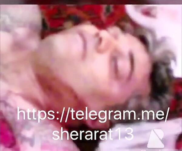 عکس پویا رسولی مراغه