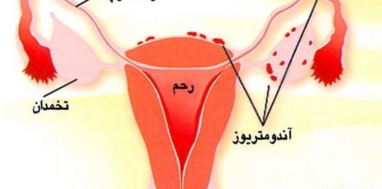 عکس تصویر لکه بینی در ماه اول بارداری