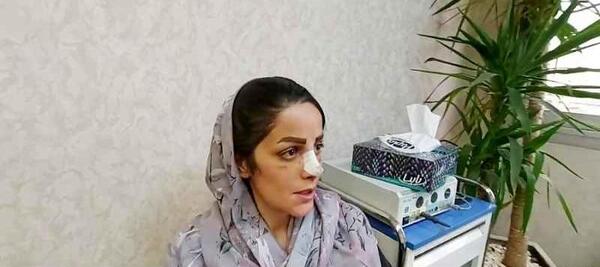 عکس یلدا سهرابی