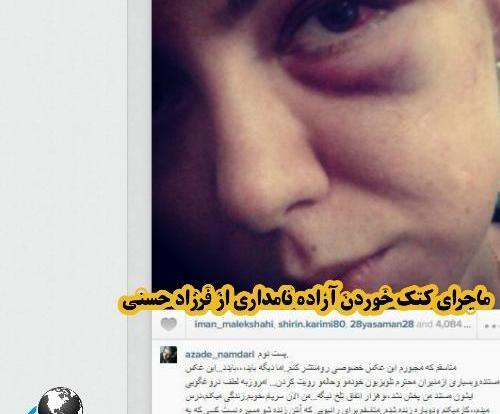 عکس صورت کتک خورده آزاده نامداری