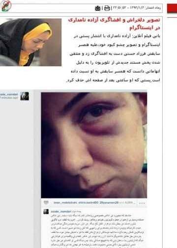 عکس صورت کتک خورده آزاده نامداری