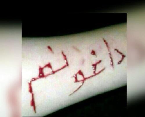 عکس غمگین چشم خونی