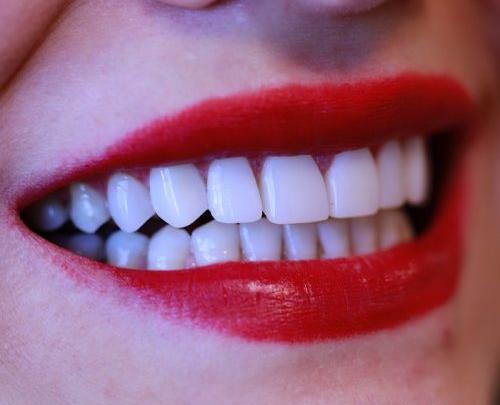 عکس دندانهای سفید