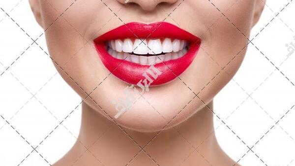 عکس دندانهای سفید