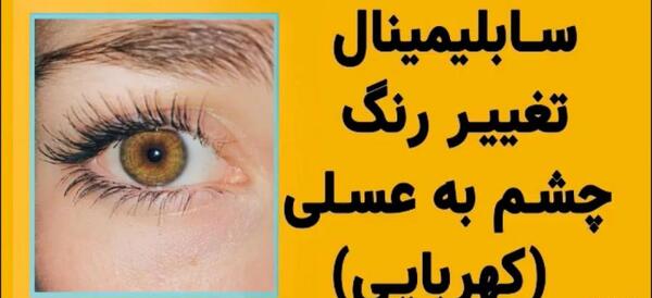 عکس چشم کهربایی