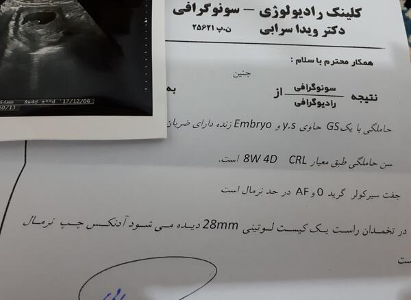 عکس قلب جنین در سونوگرافی