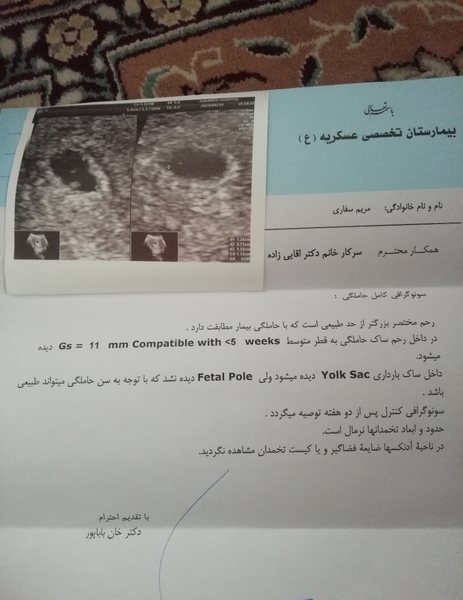 عکس قلب جنین در سونوگرافی