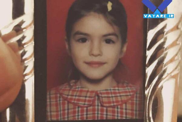 عکس خزان قبل از عمل بینی