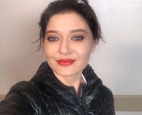 عکس نورگل یشیلچای قبل از عمل