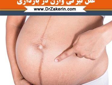 عکس بارداری زشت
