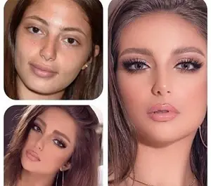 عکس چهره قبل و بعد