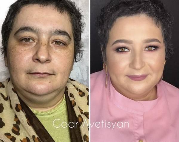 عکس چهره قبل و بعد