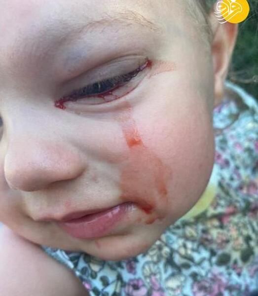 عکس گریه خون
