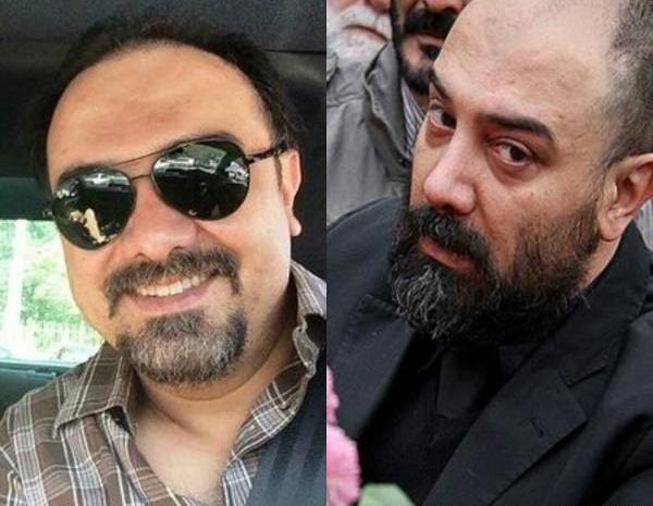 عکس قبل کاشت موی احسان علیخانی