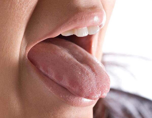 عکس سفید شدن زبان