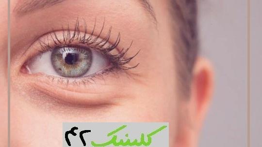 عکس چشم لیزری