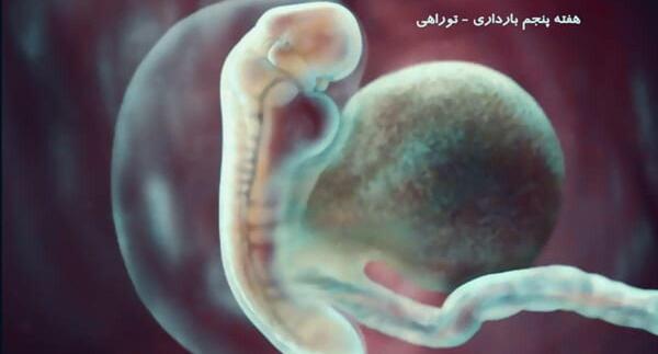 عکس لکه بینی در هفته هفتم بارداری