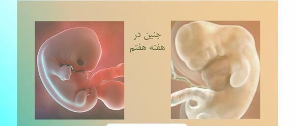 عکس لکه بینی در هفته هفتم بارداری