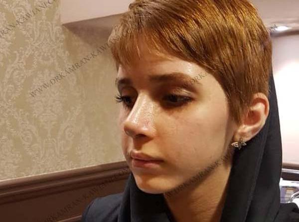 عکس فیک دخترونه دماغ عملی