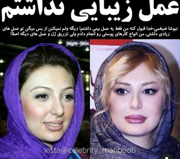 عکس قبل طناز طباطبایی