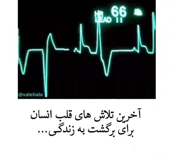 عکس ضربان قلب انسان
