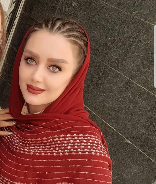 عکس شهلا قادریان قبل عمل