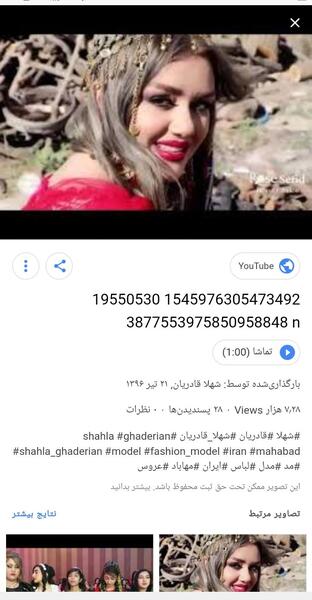 عکس شهلا قادریان قبل عمل