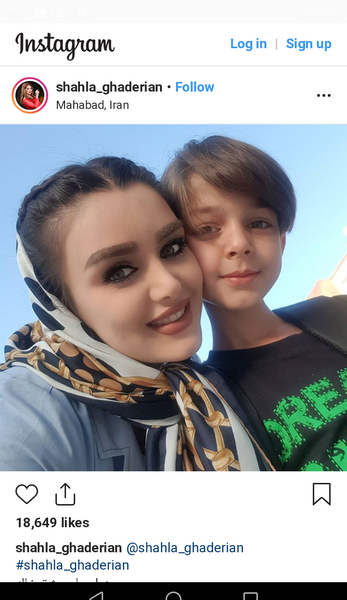 عکس شهلا قادریان قبل عمل
