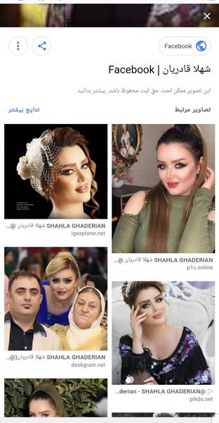 عکس شهلا قادریان قبل عمل