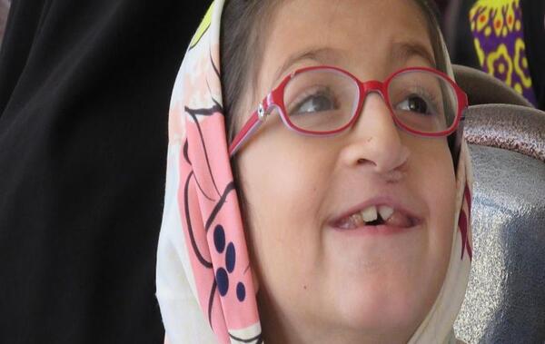 عکس بچه لب شکری