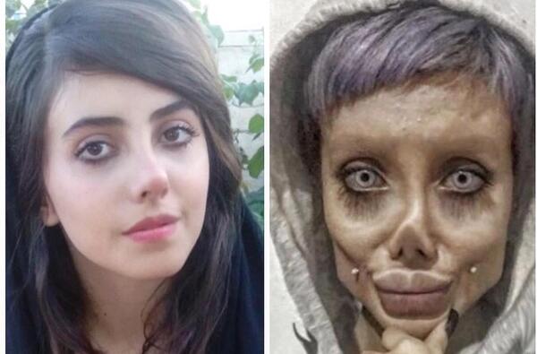 عکس گوگوش قبل از عمل جراحی