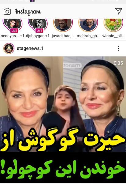 عکس گوگوش قبل از عمل جراحی