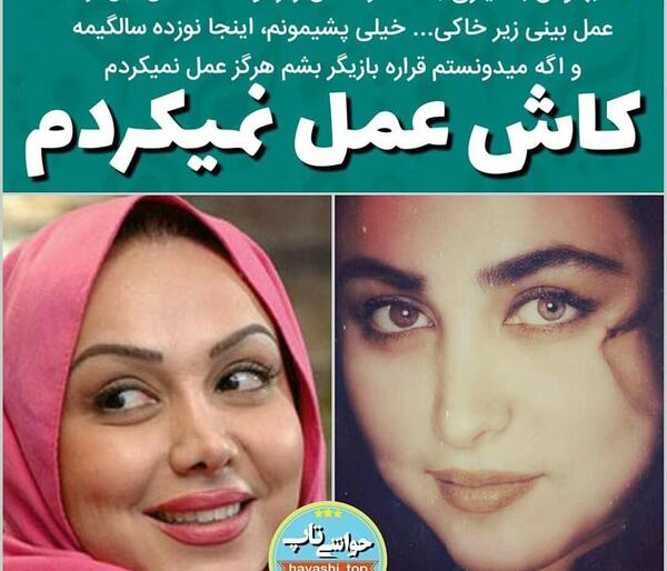 عکس قبل از عمل بهنوش بختیاری
