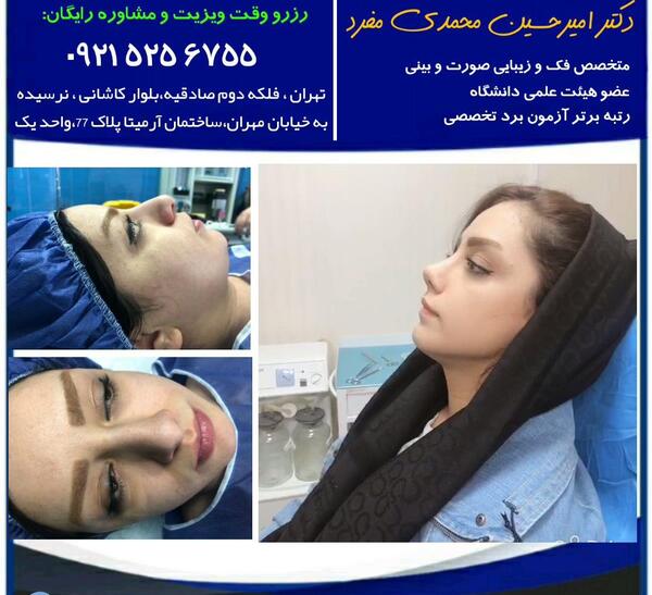 عکس قبل بعد عمل بینی