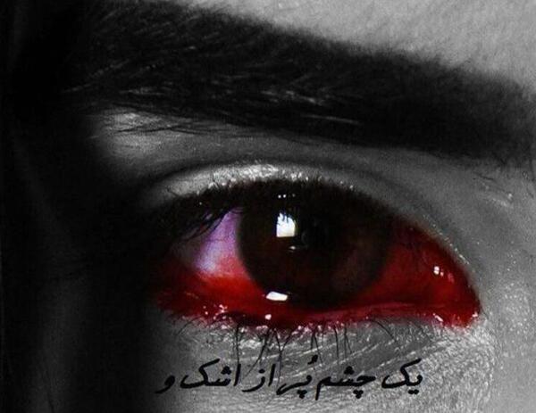 عکس های غمگین خونین