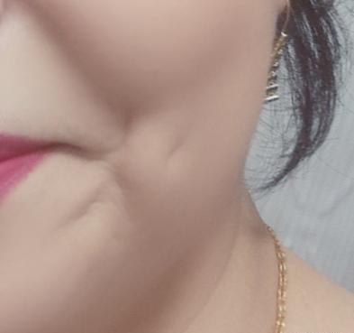 عکس لبخند چال دار