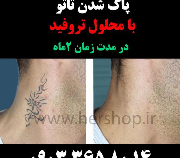 عکس تاتو نمک نداره
