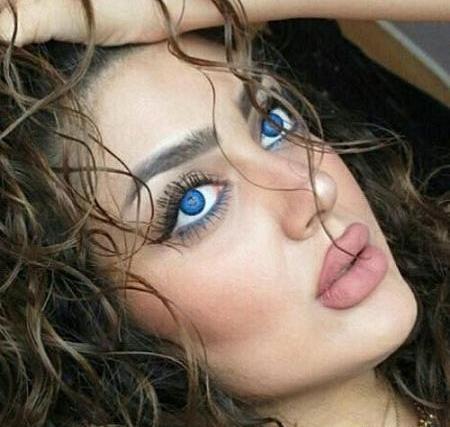 عکس قبل عمل غزاله میر