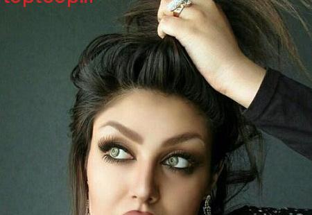 عکس قبل عمل غزاله میر