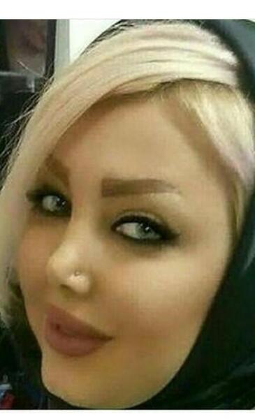 عکس قبل عمل غزاله میر