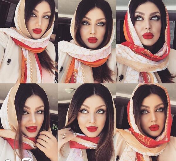 عکس قبل عمل غزاله میر