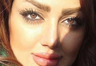 عکس قبل عمل غزاله میر