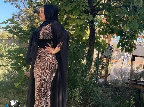 عکس قبل عمل غزاله میر