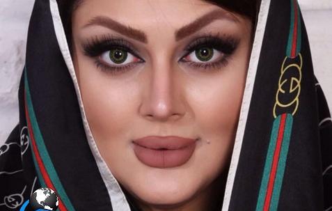 عکس قبل عمل غزاله میر