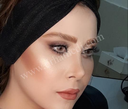 عکس کبودی بعد از عمل بینی