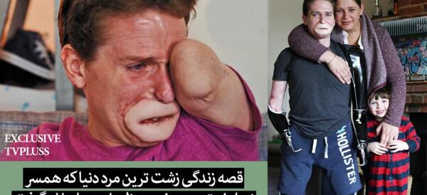 عکس زشت ترین آدم دنیا