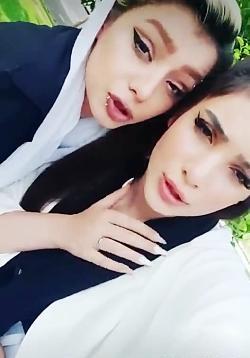 عکس فریال قبل از عمل بینی