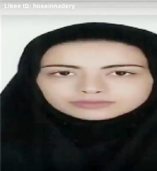 عکس فریال قبل از عمل بینی