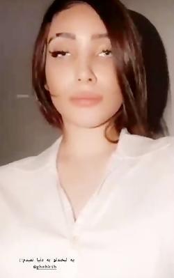 عکس فریال قبل از عمل بینی